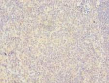 RAB6B Antibody - Immunohistochemistry of paraffin-embedded human tonsil tissue using antibody at dilution of 1:100.