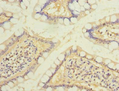 RAB6B Antibody - Immunohistochemistry of paraffin-embedded human small intestine tissue using RAB6B Antibody at dilution of 1:100