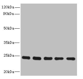 RAB6B Antibody - Western blot All lanes: RAB6B antibody at 5µg/ml Lane 1: Mouse brain tissue Lane 2: U251 whole cell lysate Lane 3: MCF-7 whole cell lysate Lane 4: A549 whole cell lysate Lane 5: K562 whole cell lysate Secondary Goat polyclonal to rabbit IgG at 1/10000 dilution Predicted band size: 24, 23 kDa Observed band size: 24 kDa