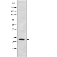RAB6B Antibody - Western blot analysis of RAB6B using Jurkat whole cells lysates