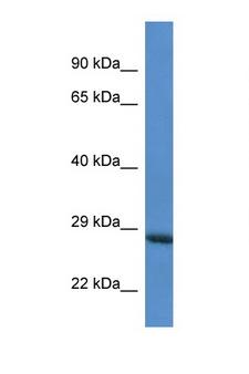 RAB6C Antibody - RAB6C antibody Western blot of HepG2 Cell lysate. Antibody concentration 1 ug/ml.  This image was taken for the unconjugated form of this product. Other forms have not been tested.