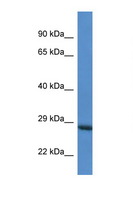 RAB6C Antibody - RAB6C antibody Western blot of HepG2 Cell lysate. Antibody concentration 1 ug/ml.  This image was taken for the unconjugated form of this product. Other forms have not been tested.