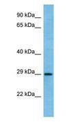RAB6C Antibody - RAB6C antibody Western Blot of Fetal Thymus.  This image was taken for the unconjugated form of this product. Other forms have not been tested.
