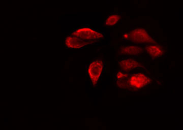 RAB6C Antibody - Staining COLO205 cells by IF/ICC. The samples were fixed with PFA and permeabilized in 0.1% Triton X-100, then blocked in 10% serum for 45 min at 25°C. The primary antibody was diluted at 1:200 and incubated with the sample for 1 hour at 37°C. An Alexa Fluor 594 conjugated goat anti-rabbit IgG (H+L) antibody, diluted at 1/600, was used as secondary antibody.