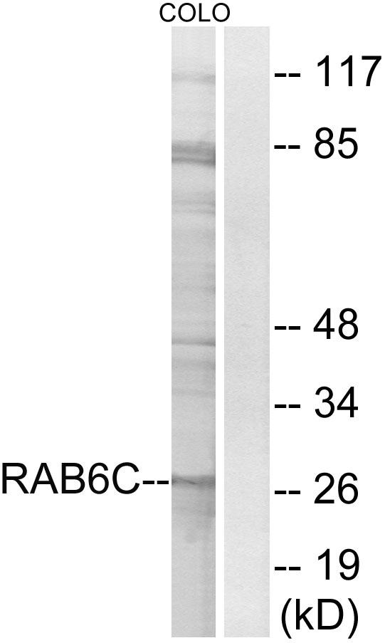 RAB6C Antibody - Western blot analysis of extracts from COLO cells, using RAB6C antibody.