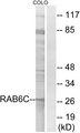 RAB6C Antibody - Western blot analysis of extracts from COLO cells, using RAB6C antibody.