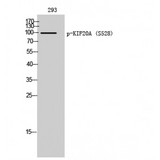 RAB6KIFL / KIF20A Antibody - Western blot of Phospho-KIF20A (S528) antibody