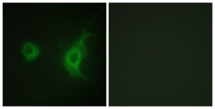 RAB6KIFL / KIF20A Antibody - Immunofluorescence analysis of HUVEC cells, using KIF20A Antibody. The picture on the right is blocked with the synthesized peptide.