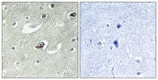 RAB6KIFL / KIF20A Antibody - Immunohistochemistry analysis of paraffin-embedded human brain tissue, using KIF20A Antibody. The picture on the right is blocked with the synthesized peptide.