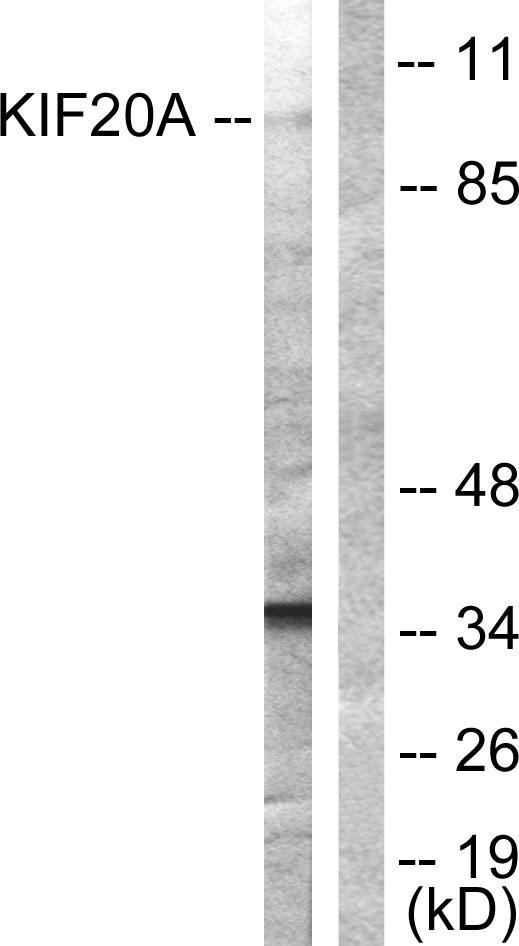 RAB6KIFL / KIF20A Antibody - Western blot analysis of lysates from 293 cells, using KIF20A Antibody. The lane on the right is blocked with the synthesized peptide.
