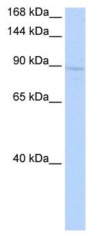 RAB6KIFL / KIF20A Antibody - Western analysis of 721_B cell lysate.  This image was taken for the unconjugated form of this product. Other forms have not been tested.