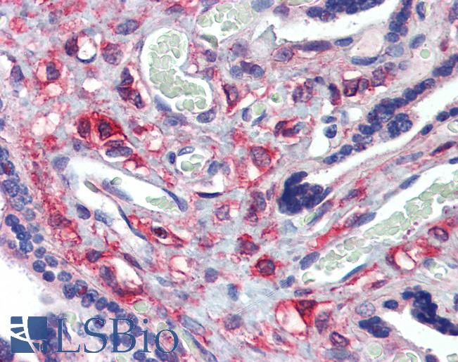 RAB6KIFL / KIF20A Antibody - Anti-KIF20A antibody IHC of human placenta. Immunohistochemistry of formalin-fixed, paraffin-embedded tissue after heat-induced antigen retrieval. Antibody concentration 5 ug/ml.  This image was taken for the unconjugated form of this product. Other forms have not been tested.