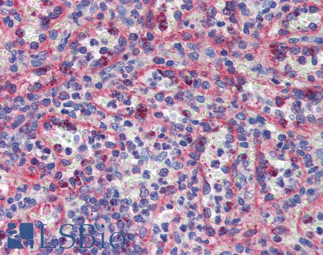 RAB6KIFL / KIF20A Antibody - Anti-KIF20A antibody IHC of human spleen. Immunohistochemistry of formalin-fixed, paraffin-embedded tissue after heat-induced antigen retrieval. Antibody concentration 5 ug/ml.  This image was taken for the unconjugated form of this product. Other forms have not been tested.