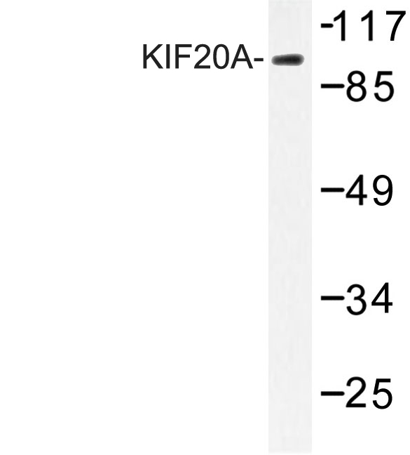 RAB6KIFL / KIF20A Antibody - Western blot of KIF20A (I524) pAb in extracts from 293 cells.