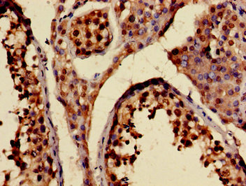 RAB6KIFL / KIF20A Antibody - Immunohistochemistry image of paraffin-embedded human testis tissue at a dilution of 1:100