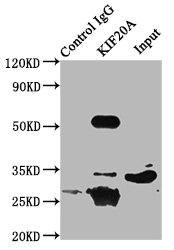 RAB6KIFL / KIF20A Antibody - Immunoprecipitating KIF20A in 293 whole cell lysate Lane 1: Rabbit control IgG (1µg) instead of KIF20A Antibody in 293 whole cell lysate.For western blotting, a HRP-conjugated Protein G antibody was used as the secondary antibody (1/2000) Lane 2: KIF20A Antibody (6µg) + 293 whole cell lysate (500µg) Lane 3: 293 whole cell lysate (10µg)