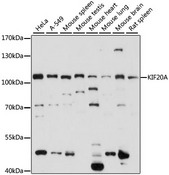 RAB6KIFL / KIF20A Antibody - Western blot analysis of extracts of various cell lines, using KIF20A antibody at 1:1000 dilution. The secondary antibody used was an HRP Goat Anti-Rabbit IgG (H+L) at 1:10000 dilution. Lysates were loaded 25ug per lane and 3% nonfat dry milk in TBST was used for blocking. An ECL Kit was used for detection and the exposure time was 15s.