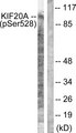 RAB6KIFL / KIF20A Antibody - Western blot analysis of lysates from 293 cells, using KIF20A (Phospho-Ser528) Antibody. The lane on the right is blocked with the phospho peptide.