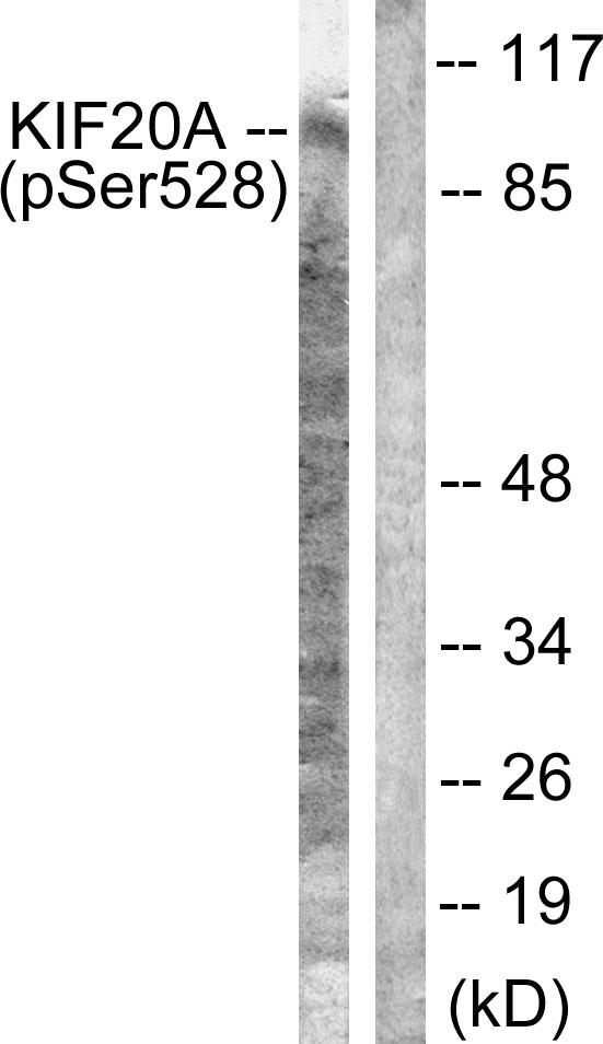 RAB6KIFL / KIF20A Antibody - Western blot analysis of extracts from 293 cells, using KIF20A (Phospho-Ser528) antibody.