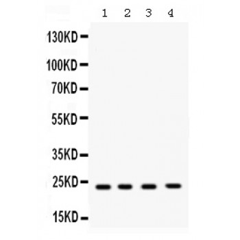 RAB7A / RAB7 Antibody - Western blot analysis of RAB7 expression in rat brain extract (lane 1), mouse spleen extract (lane 2), HELA whole cell lysates (lane 3) and MCF-7 whole cell lysates (lane 4). RAB7 at 23 kD was detected using rabbit anti- RAB7 Antigen Affinity purified polyclonal antibody at 0.5 ug/mL. The blot was developed using chemiluminescence (ECL) method.