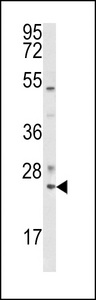 RAB7A / RAB7 Antibody - Western blot of RAB7 Antibody in K562 cell line lysates (35 ug/lane). RAB7 (arrow) was detected using the purified antibody.