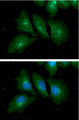 RAB7A / RAB7 Antibody - ICC/IF analysis of RAB7A in HeLa cells. The cell was stained with RAB7A antibody (1:100). The secondary antibody (green) was used Alexa Fluor 488. DAPI was stained the cell nucleus (blue).
