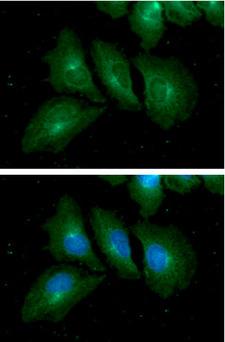 RAB7A / RAB7 Antibody - ICC/IF analysis of RAB7A in HeLa cells. The cell was stained with RAB7A antibody (1:100). The secondary antibody (green) was used Alexa Fluor 488. DAPI was stained the cell nucleus (blue).