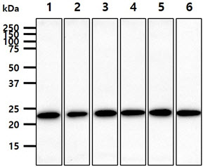 RAB7A / RAB7 Antibody - The cell lysates (40ug) were resolved by SDS-PAGE, transferred to PVDF membrane and probed with anti-human RAB7A antibody (1:1000). Proteins were visualized using a goat anti-mouse secondary antibody conjugated to HRP and an ECL detection system. Lane 1.: HeLa cell lysate Lane 2.: Jurkat cell lysate Lane 3.: MCF7 cell lysate Lane 4.: PC3 cell lysate Lane 5.: 293T cell lysate Lane 6.: SK-OV-3 cell lysate
