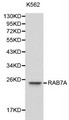 RAB7A / RAB7 Antibody - Western blot of RAB7A pAb in extracts from K562 cells.