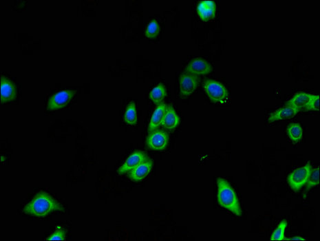RAB7A / RAB7 Antibody - Immunofluorescent analysis of HepG2 cells using RAB7A Antibody at a dilution of 1:100 and Alexa Fluor 488-congugated AffiniPure Goat Anti-Rabbit IgG(H+L)