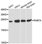 RAB7A / RAB7 Antibody - Western blot analysis of extracts of various cell lines, using RAB7A antibody at 1:3000 dilution. The secondary antibody used was an HRP Goat Anti-Rabbit IgG (H+L) at 1:10000 dilution. Lysates were loaded 25ug per lane and 3% nonfat dry milk in TBST was used for blocking. An ECL Kit was used for detection and the exposure time was 90s.
