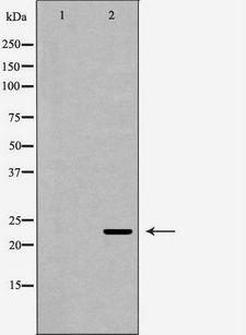 RAB7A / RAB7 Antibody - Western blot analysis of K562 lysate usingRAB7A antibody. The lane on the left is treated with the antigen-specific peptide.