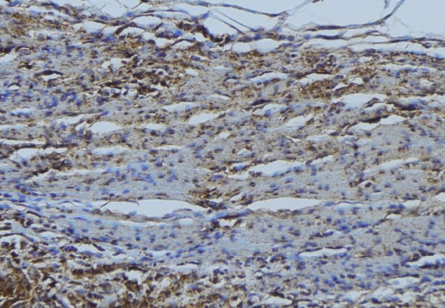 RAB7A / RAB7 Antibody - 1:100 staining mouse muscle tissue by IHC-P. The sample was formaldehyde fixed and a heat mediated antigen retrieval step in citrate buffer was performed. The sample was then blocked and incubated with the antibody for 1.5 hours at 22°C. An HRP conjugated goat anti-rabbit antibody was used as the secondary.