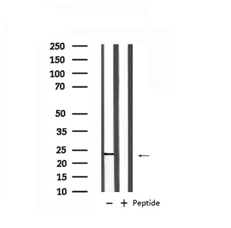 RAB7A / RAB7 Antibody - Western blot analysis of extracts of HeLa cells using RAB7A antibody. Lane 1 was treated with the antigen-specific peptide.