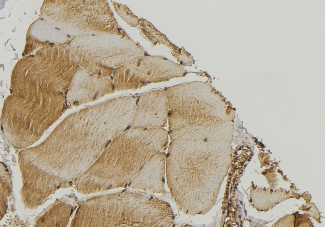 RAB7A / RAB7 Antibody - 1:100 staining mouse muscle tissue by IHC-P. The sample was formaldehyde fixed and a heat mediated antigen retrieval step in citrate buffer was performed. The sample was then blocked and incubated with the antibody for 1.5 hours at 22°C. An HRP conjugated goat anti-rabbit antibody was used as the secondary.