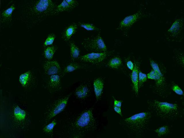 RAB7A / RAB7 Antibody - Immunofluorescence staining of RAB7A in U251MG cells. Cells were fixed with 4% PFA, permeabilzed with 0.1% Triton X-100 in PBS, blocked with 10% serum, and incubated with rabbit anti-Human RAB7A polyclonal antibody (dilution ratio 1:100) at 4°C overnight. Then cells were stained with the Alexa Fluor 488-conjugated Goat Anti-rabbit IgG secondary antibody (green) and counterstained with DAPI (blue). Positive staining was localized to Cytoplasm.