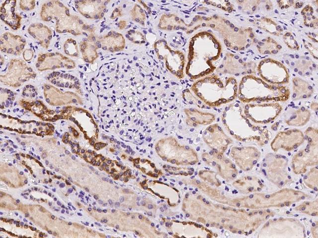 RAB7A / RAB7 Antibody - Immunochemical staining of human RAB7A in human kidney with rabbit polyclonal antibody at 1:100 dilution, formalin-fixed paraffin embedded sections.