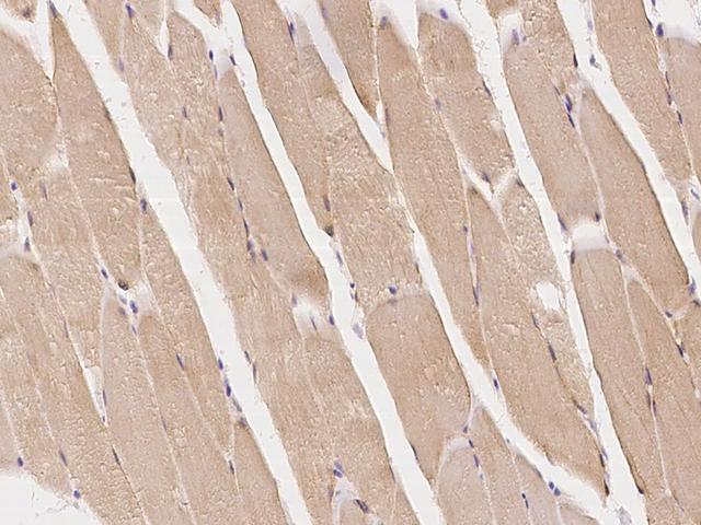 RAB7A / RAB7 Antibody - Immunochemical staining of human RAB7A in human skeletal muscle with rabbit polyclonal antibody at 1:100 dilution, formalin-fixed paraffin embedded sections.