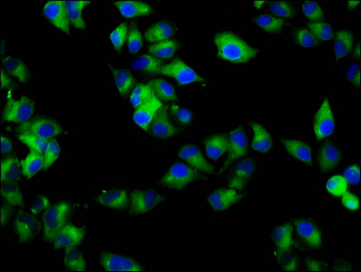RAB7B Antibody - Immunofluorescence staining of Hela cells diluted at 1:133, counter-stained with DAPI. The cells were fixed in 4% formaldehyde, permeabilized using 0.2% Triton X-100 and blocked in 10% normal Goat Serum. The cells were then incubated with the antibody overnight at 4°C.The Secondary antibody was Alexa Fluor 488-congugated AffiniPure Goat Anti-Rabbit IgG (H+L).