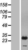 RAB7B Protein - Western validation with an anti-DDK antibody * L: Control HEK293 lysate R: Over-expression lysate