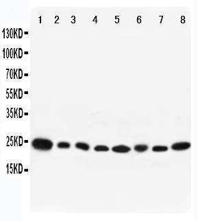 RAB8A / RAB8 Antibody - WB of RAB8A / RAB8 antibody. All lanes: Anti-RAB8A at 0.5ug/ml. Lane 1: Rat Brain Tissue Lysate at 40ug. Lane 2: Mouse Brain Tissue Lysate at 40ug. Lane 3: Human Placenta Tissue Lysate at 40ug. Lane 4: HELA Whole Cell Lysate at 40ug. Lane 5: PC12 Whole Cell Lysate at 40ug. Lane 6: NIH Whole Cell Lysate at 40ug. Lane 7: A431 Whole Cell Lysate at 40ug. Lane 8: 293T Whole Cell Lysate at 40ug. Predicted bind size: 24KD. Observed bind size: 24KD.