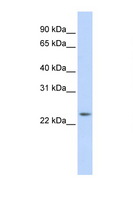 RAB8A / RAB8 Antibody - RAB8A antibody Western blot of 721_B Cell lysate. Antibody concentration 1 ug/ml. This image was taken for the unconjugated form of this product. Other forms have not been tested.