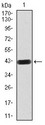 RAB8A / RAB8 Antibody - Western blot analysis using Rab8 mAb against human Rab8 (AA: 68-207) recombinant protein. (Expected MW is 42 kDa)