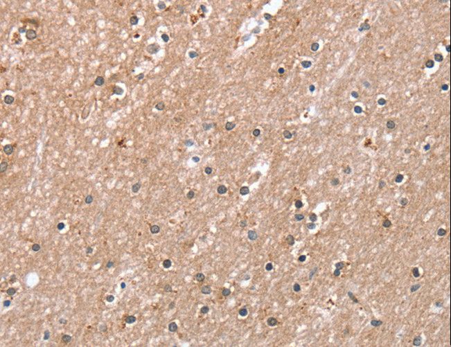 RAB8A / RAB8 Antibody - Immunohistochemistry of paraffin-embedded Human brain using RAB8A Polyclonal Antibody at dilution of 1:45.