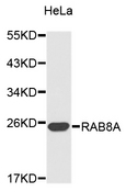 RAB8A / RAB8 Antibody - Western blot analysis of extracts of HeLa cells.