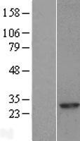 RAB8A / RAB8 Protein - Western validation with an anti-DDK antibody * L: Control HEK293 lysate R: Over-expression lysate