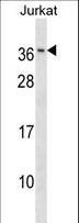 RAB8B Antibody - RAB8B Antibody western blot of Jurkat cell line lysates (35 ug/lane). The RAB8B antibody detected the RAB8B protein (arrow).