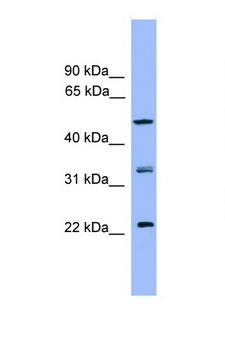 RAB8B Antibody - RAB8B antibody Western blot of HepG2 Cell lysate. Antibody concentration 1 ug/ml.  This image was taken for the unconjugated form of this product. Other forms have not been tested.