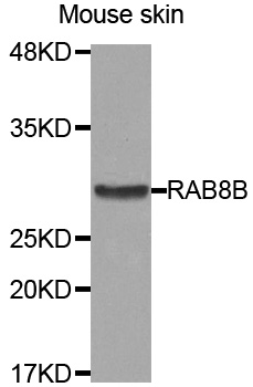 RAB8B Antibody - Western blot analysis of extracts of Mouse skin cell line, using RAB8B antibody.
