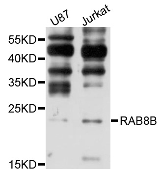 RAB8B Antibody - Western blot analysis of extracts of various cells.